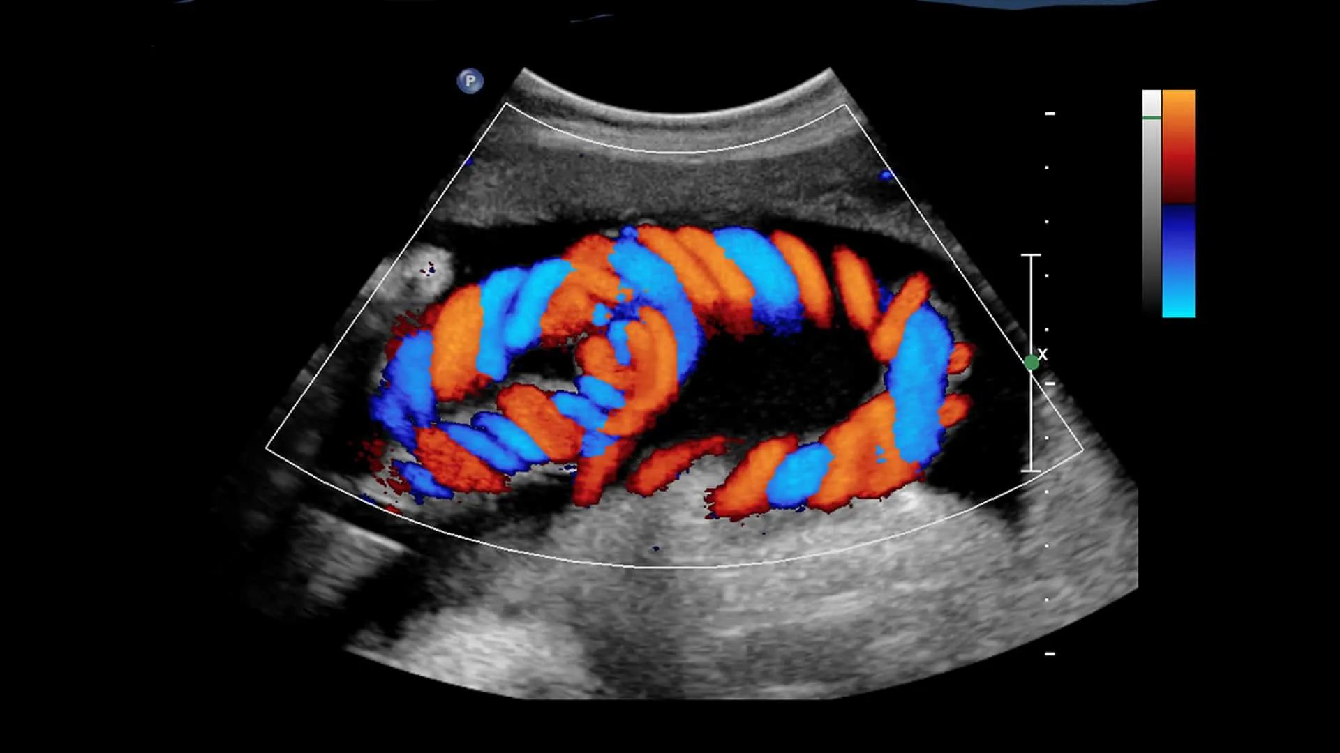 mri-scan-in-ahmedabad
